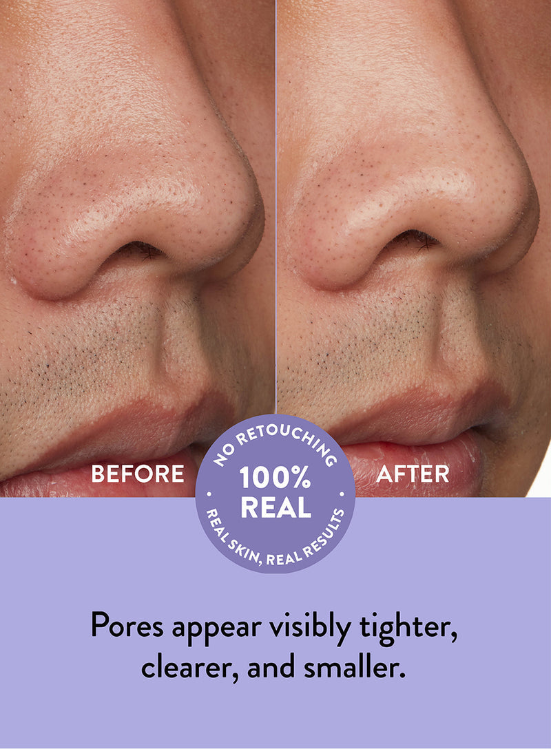 Nose Pore Patches